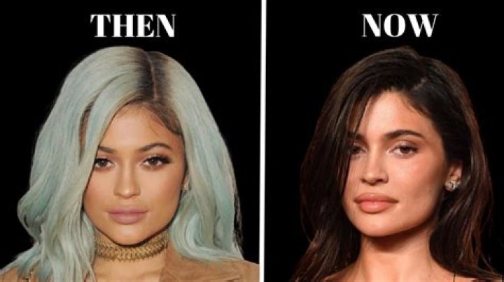 Kylie Jenner Recovers from Painful Surgery